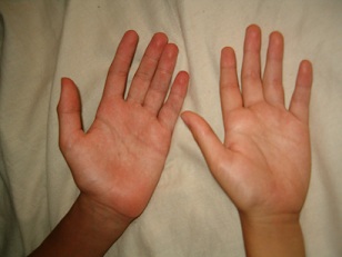 Hands Up
